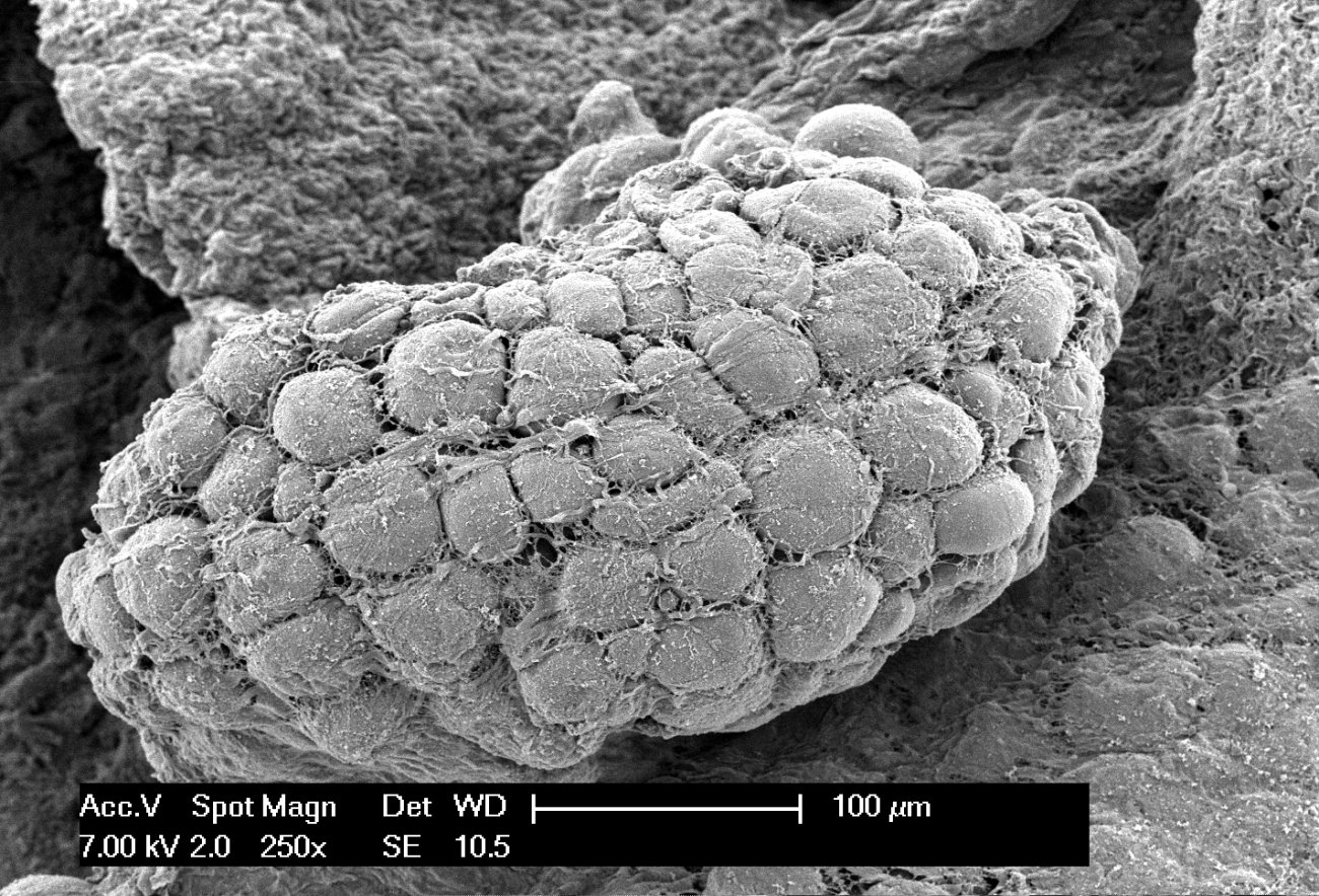 Adipocytes_ScanningElectronMicroscope