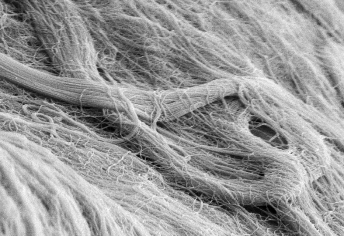 CollagenFibres_ScanningElectronMicroscope