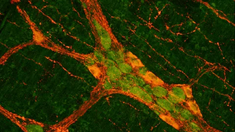 Enteric-Nervous-System-Health-Disease
