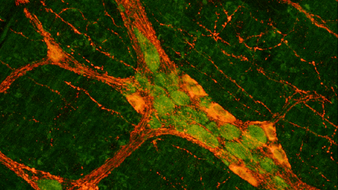 Enteric-Nervous-System-Health-Disease