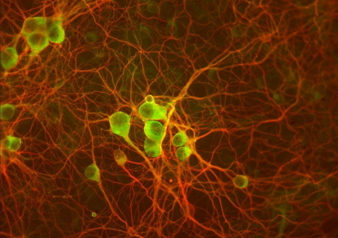 Neuroscience Centre - Image of cerebellar neurons